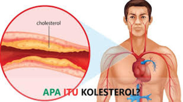 Apa Itu Kolesterol Penyebab, Gejala, dan Cara Mengatasinya