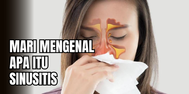 Sinusitis Ketika Rongga Wajah Menjadi Medan Peradangan