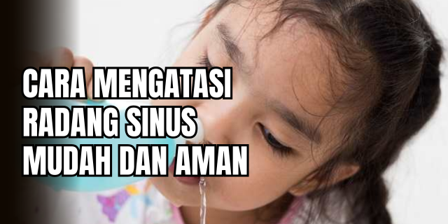 Sinusitis Bukan Sekadar Pilek Strategi Medis dan Alami untuk Meredakan Radang Sinus